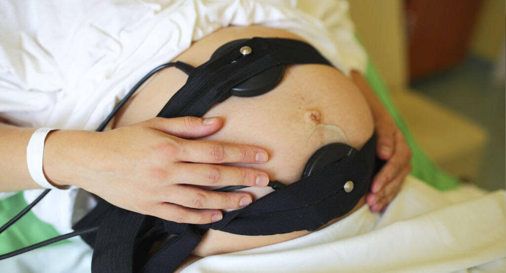 КТГ при беременности: что это за процедура и зачем она нужна